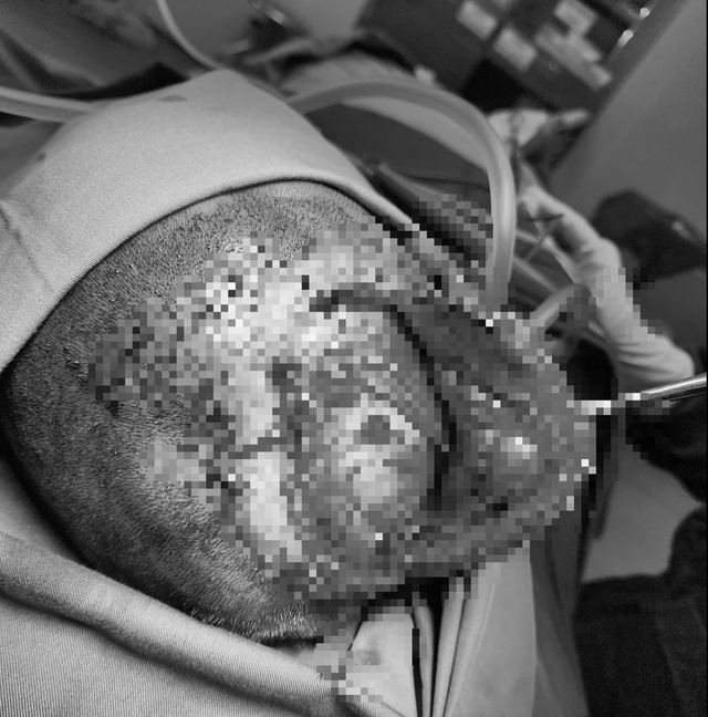 edit-img4741-176527196377798993995 Vụ nhiều người thương vong sau tai nạn trên cao tốc: Tình trạng sức khỏe các nạn nhân hiện ra sao?- Ảnh 1.